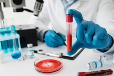 best pathology lab in bhawanipur, best lab for blood test in bhawanipur, best nabl lab in bhawanipur